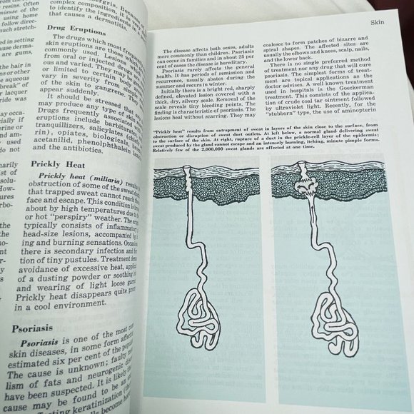 Better Homes And Gardens' Family Medical Guide 1976 Largre Book with Sleeve - Picture 10 of 16